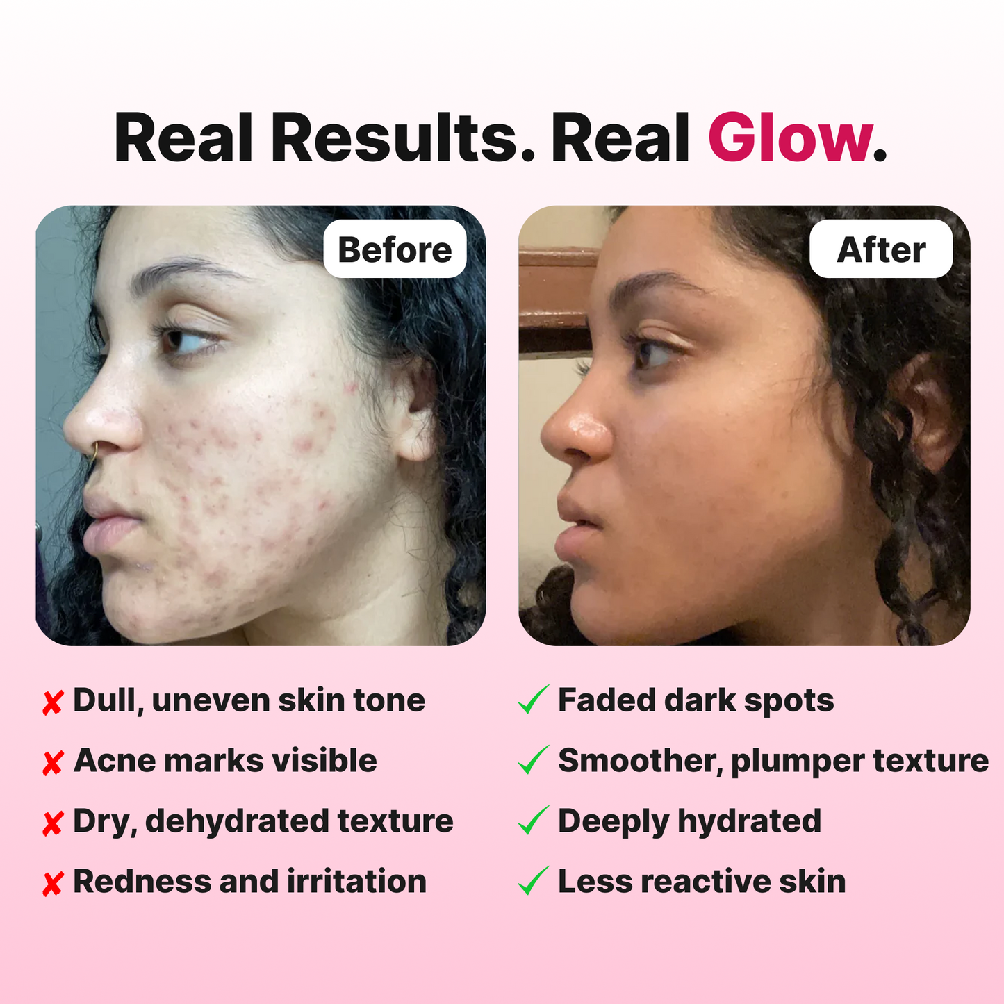 Cleo™ Korean Toner Face Pads