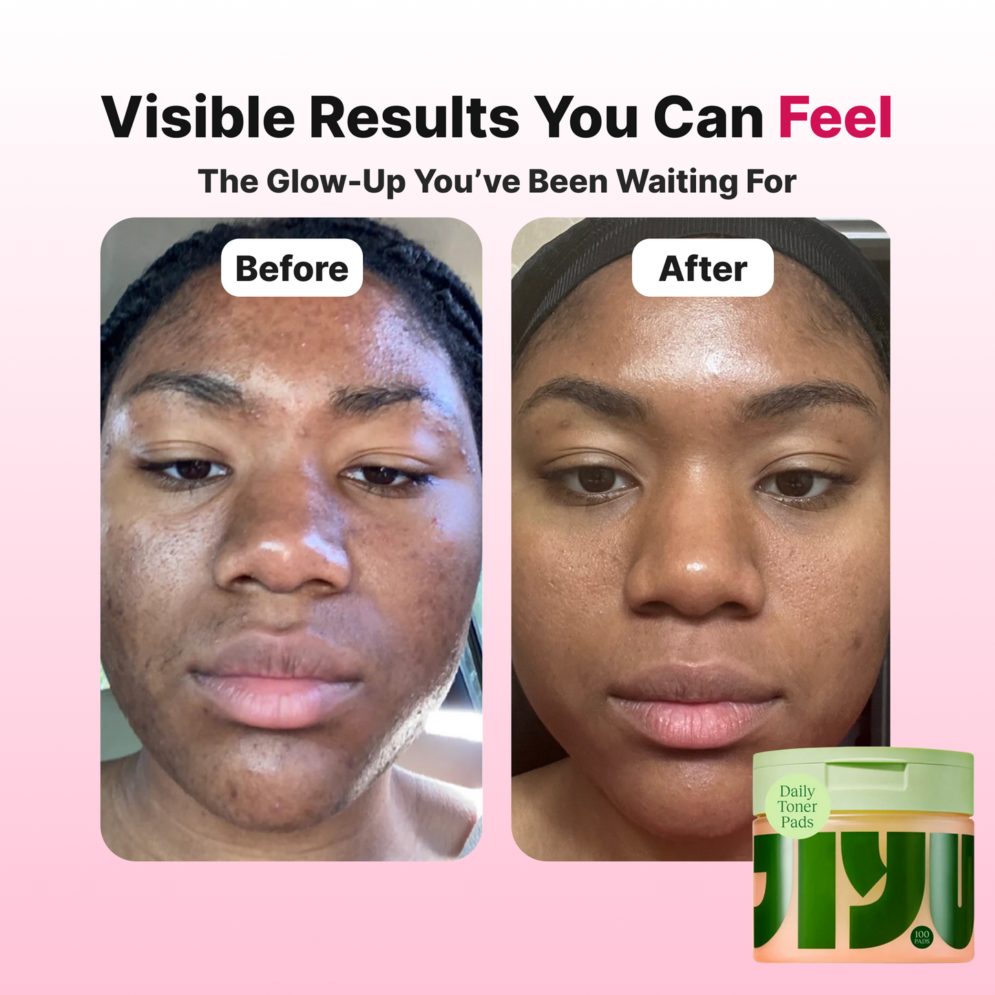 Cleo™ Korean Toner Face Pads